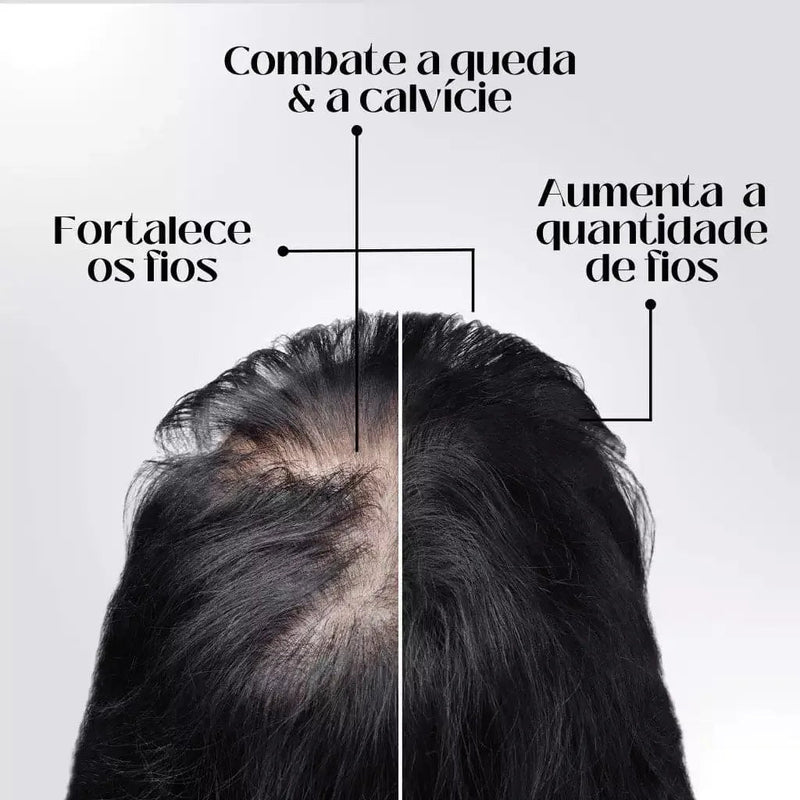 Kit 4 Repair Hair Regrowth - Óleo de Crescimento Capilar