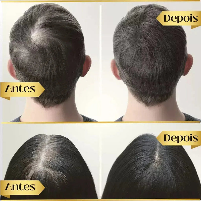 Kit 4 Repair Hair Regrowth - Óleo de Crescimento Capilar